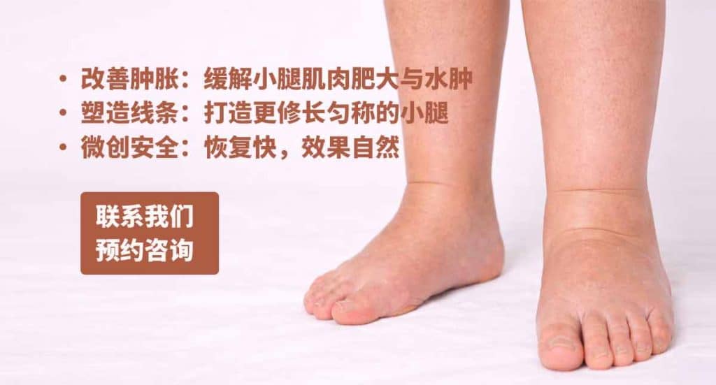 小腿肿胀